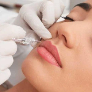 Procedimiento — Sonrisa gingival en Nerja