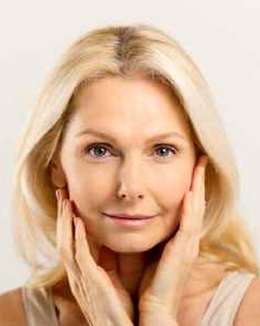 Fotorejuvenecimiento facial