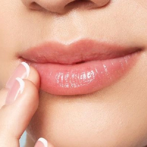 Recuperación — Sonrisa gingival en Nerja