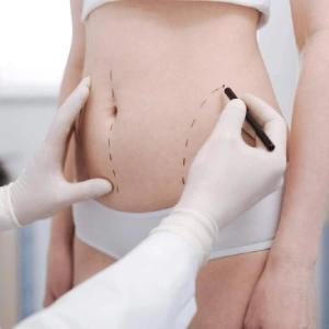 Evaluación inicial — Mesoterapia corporal en Nerja