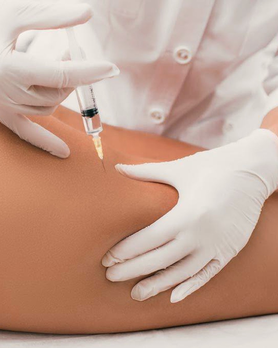 Mesoterapia corporal