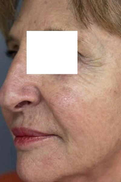 Antes — Polinucleotidos 1 - Antes