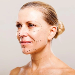 Procedimiento — Tratamiento Full Face
