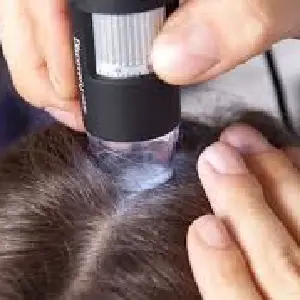 Procedimiento — Laboratorios Kapyderm