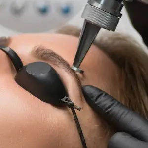 Procedimiento — Eliminación de microblading y micropigmentación